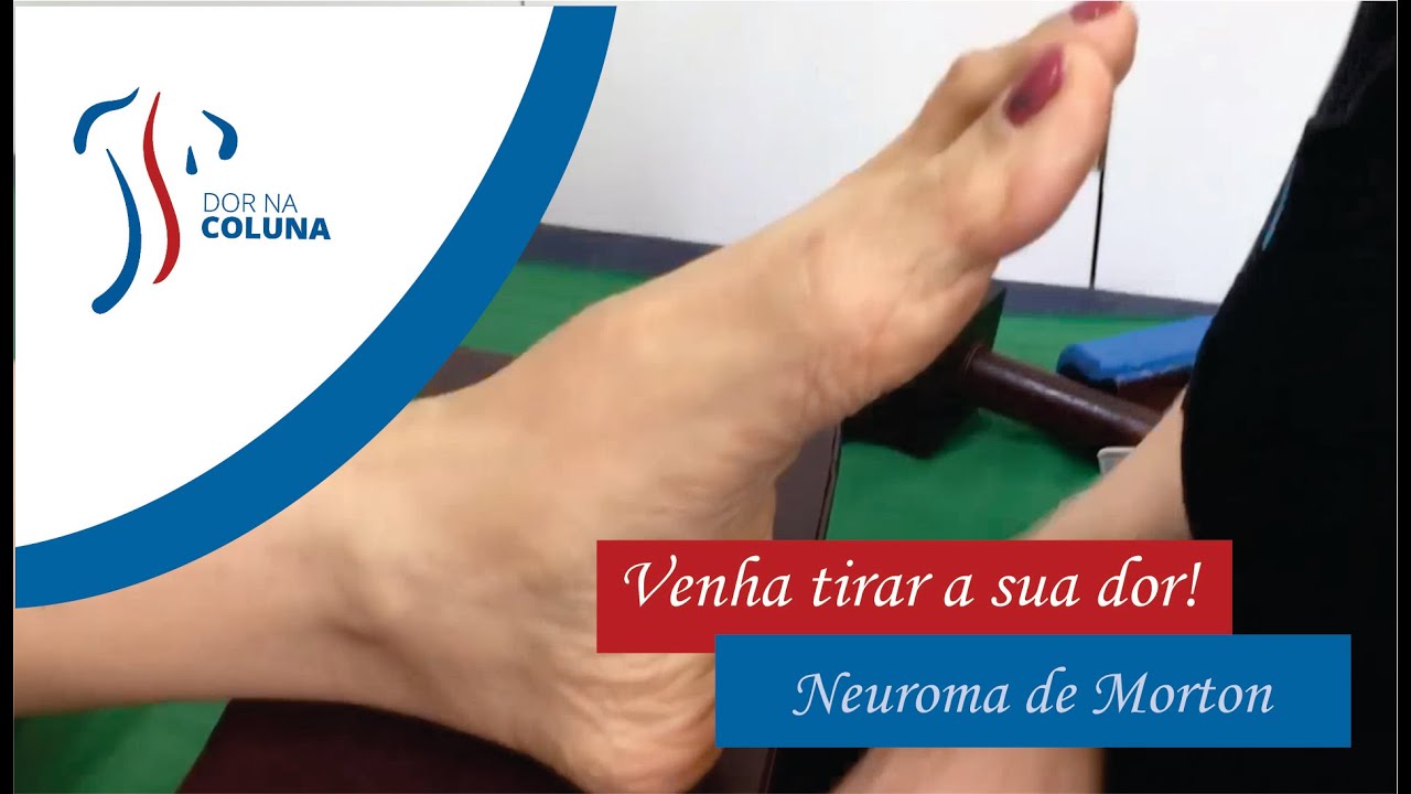 Neuroma de Morton, precisando tratar o seu?