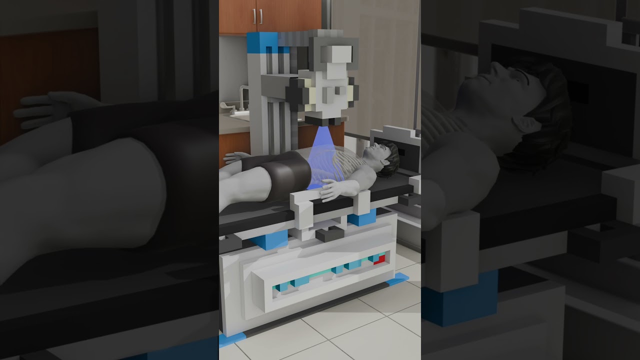 Как работает рентгеновская визуализация: упрощено с помощью 3D-анимации