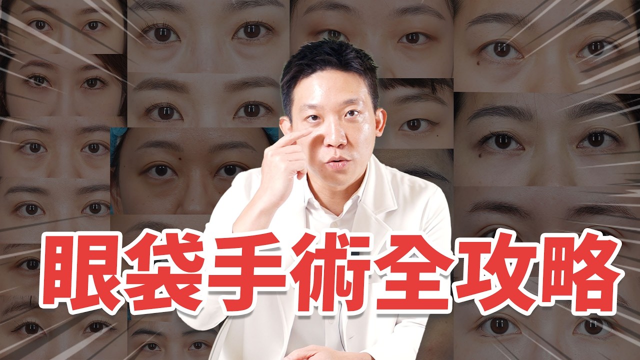 眼袋手術終極QA！多久復發？能改善黑眼圈/皺紋？打過玻尿酸可手術？只做一邊可嗎？術後瘀青嚴重的原因｜新聖整形外科 林子宇醫師