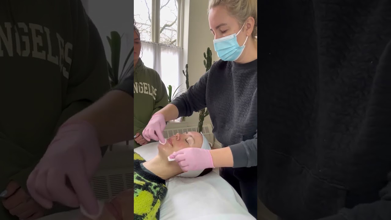 KrX Aesthetics LaZer Peel Demo