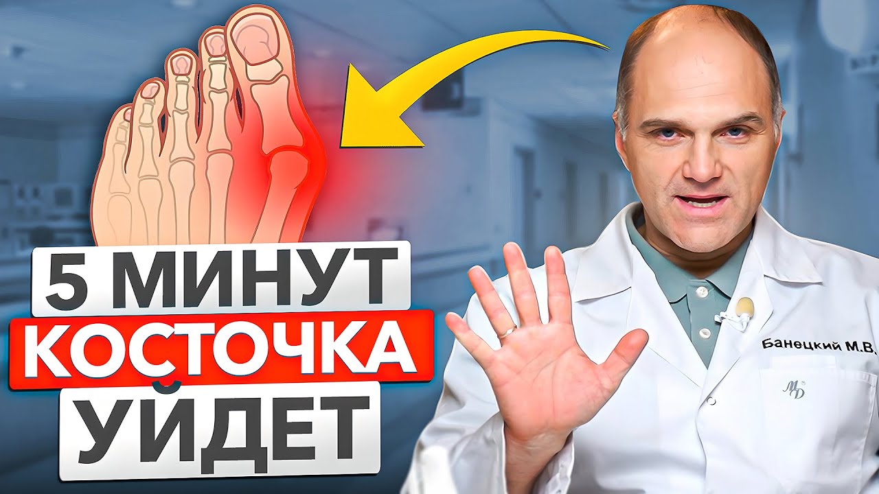 Косточка на большом пальце ноги уйдёт за 5 минут навсегда. Лечение Halux Valgus без операции.