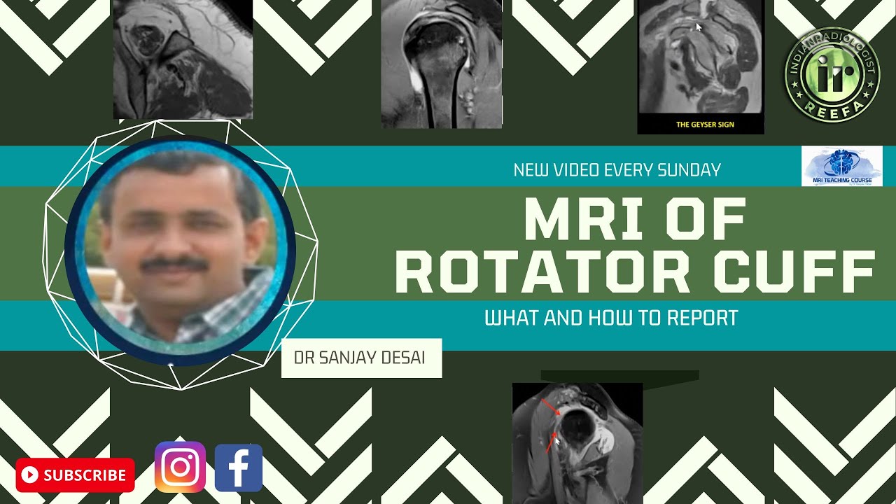 MRI ROTATOR CUFF PATHOLOGIES - WHAT TO REPORT | DR SANJAY DESAI | 22NDMRICOURSE | #indianradiologist