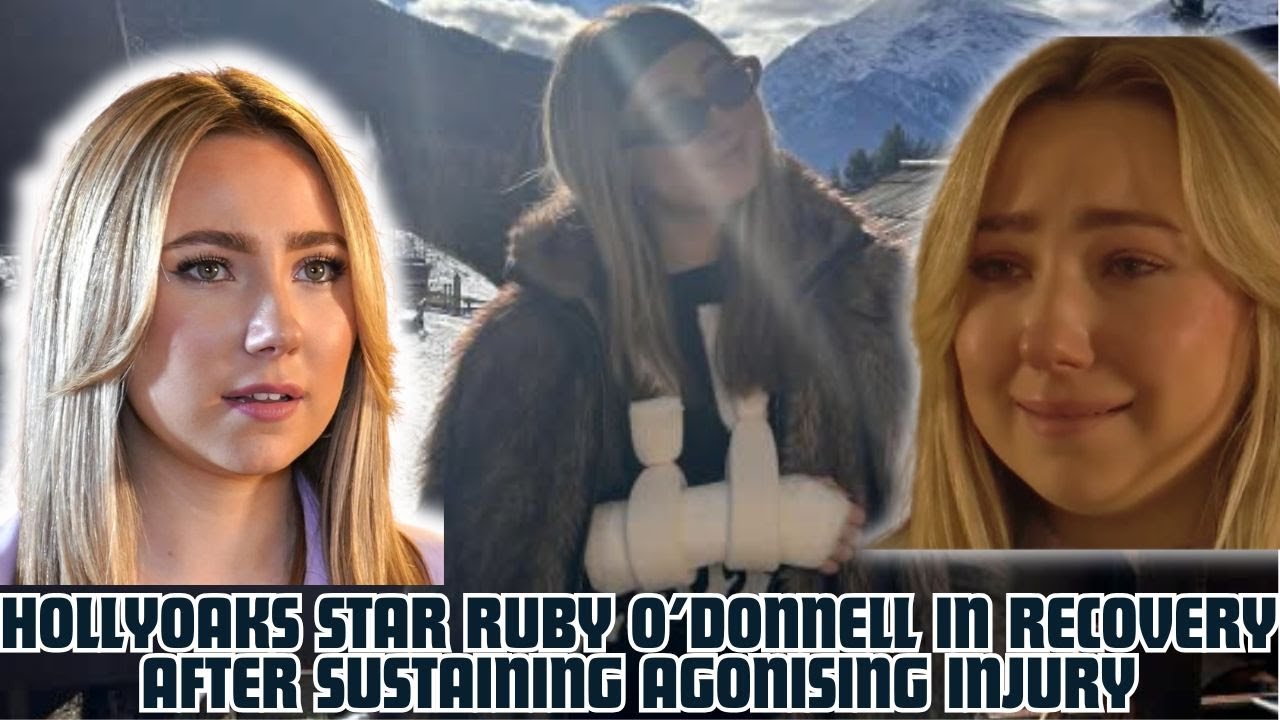 Hollyoaks star Ruby O’Donnell in recovery after sustaining agonising injury