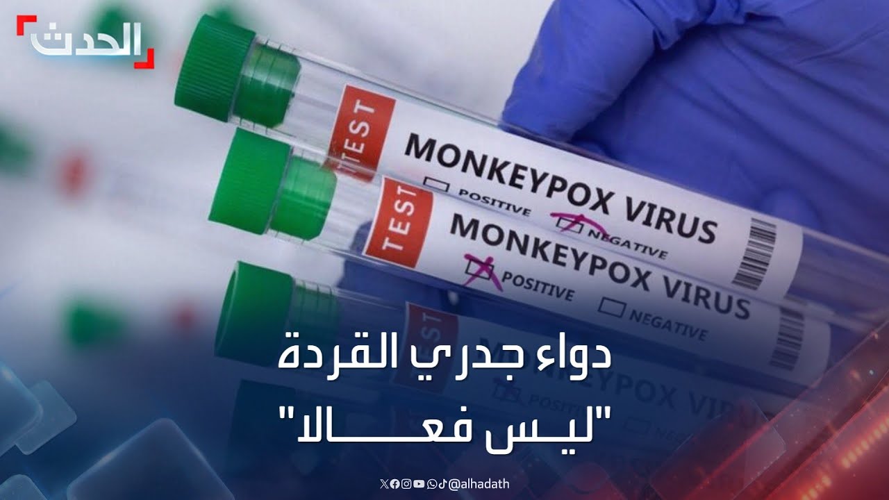دواء جدري القردة يخيب الآمال