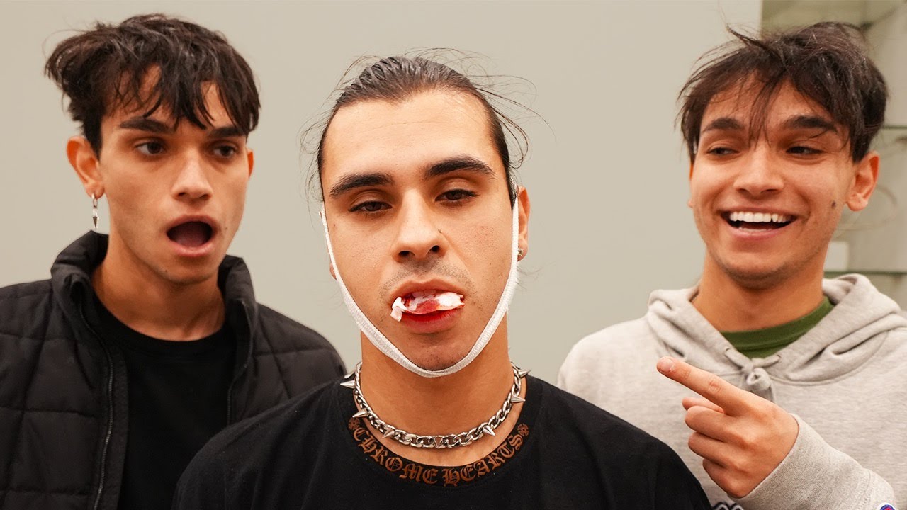 OUR BROTHER GOT HIS WISDOM TEETH REMOVED!