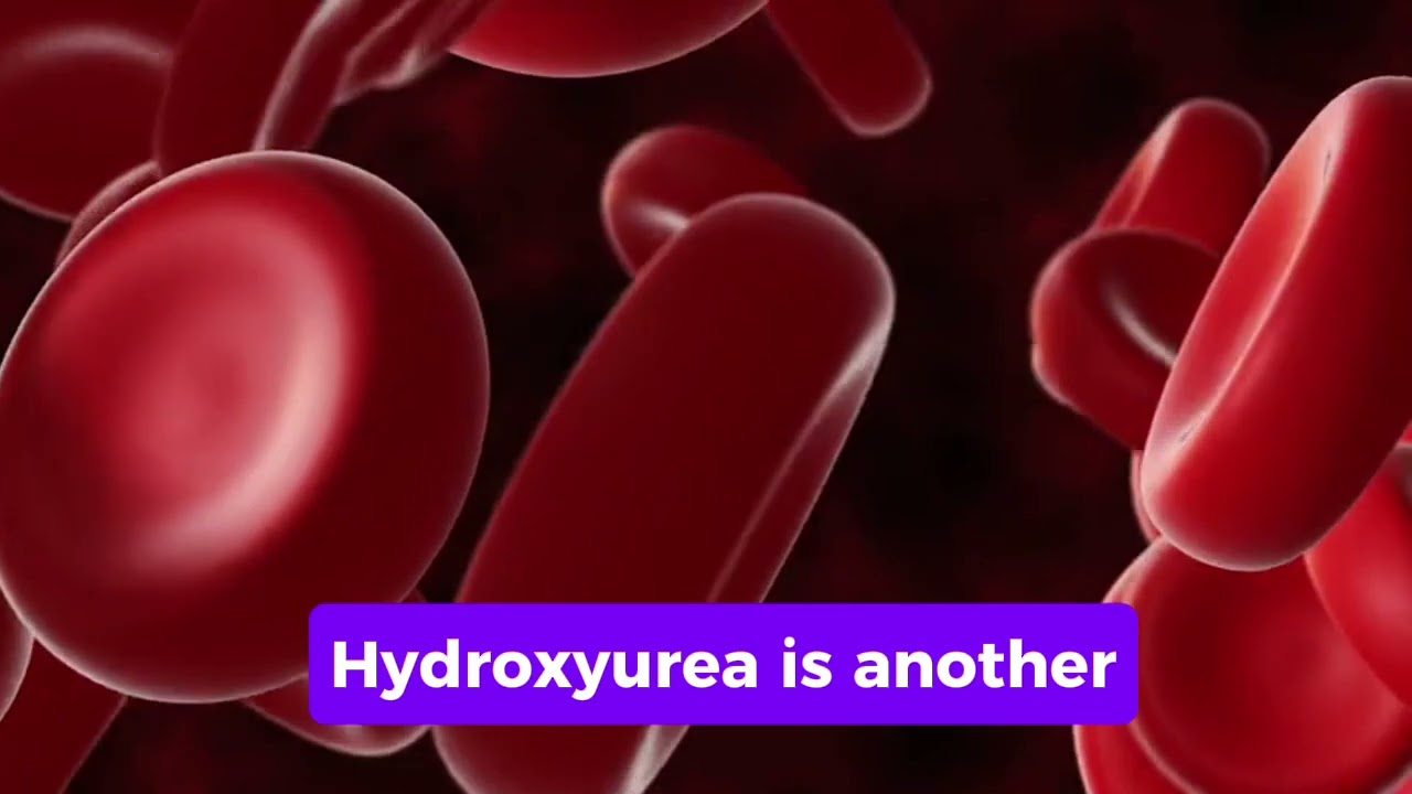 Management of Sickle Cell Disease 