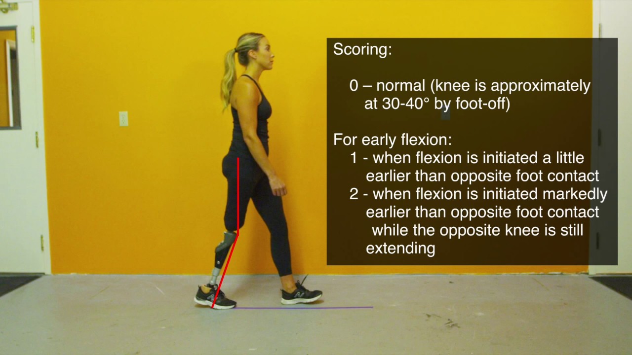 Prosthetic Observational Gait Scale (POGS)