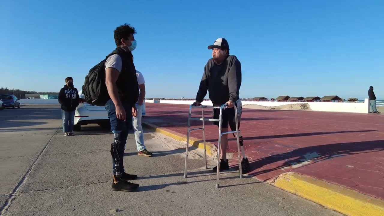 Episodio 87 Prótesis arriba de rodilla en Playa Miramar, Tampico. 🦿😎