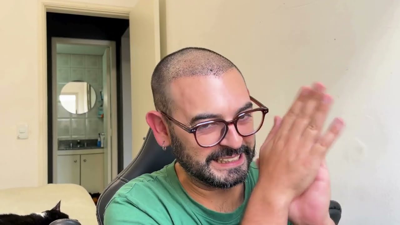 TRANSPLANTE CAPILAR VEIO AI!