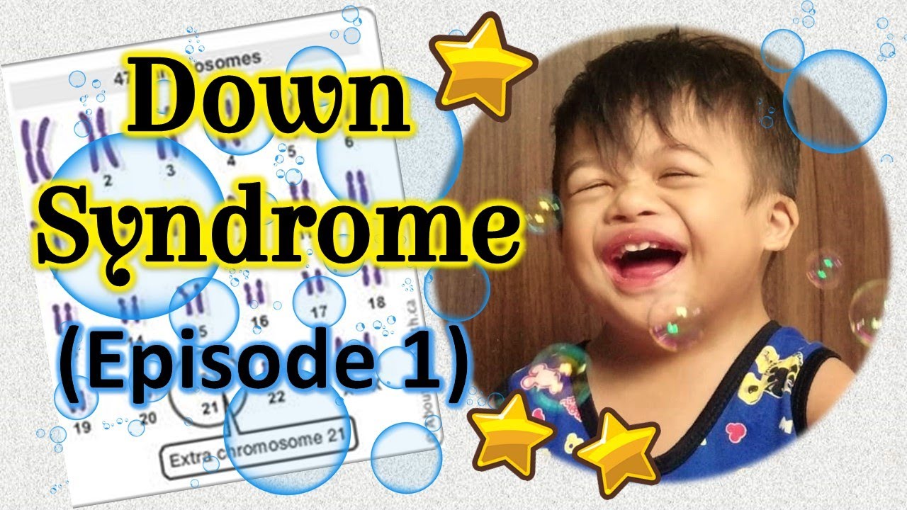Down Syndrome (Episode1)