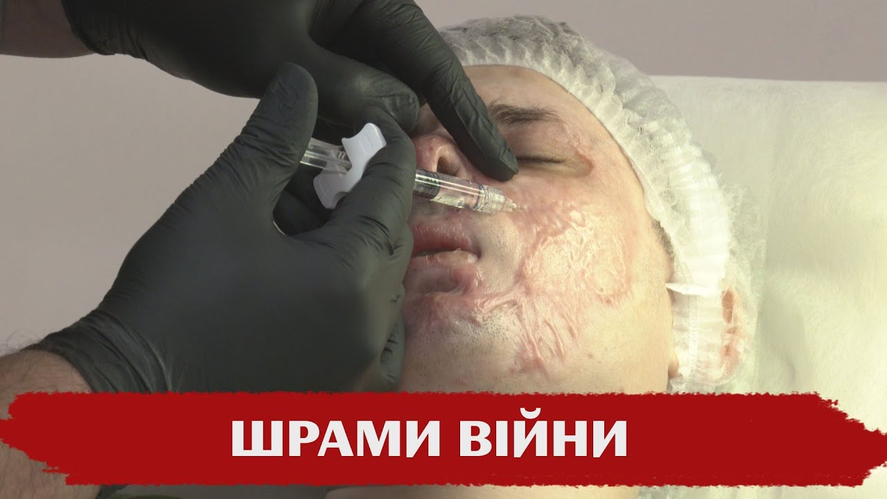 Шрами війни. 