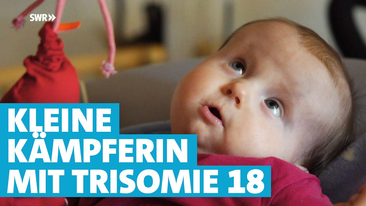 Medizinisch ein kleines Wunder: Mia hat Trisomie 18 und ist jetzt 10 Monate alt