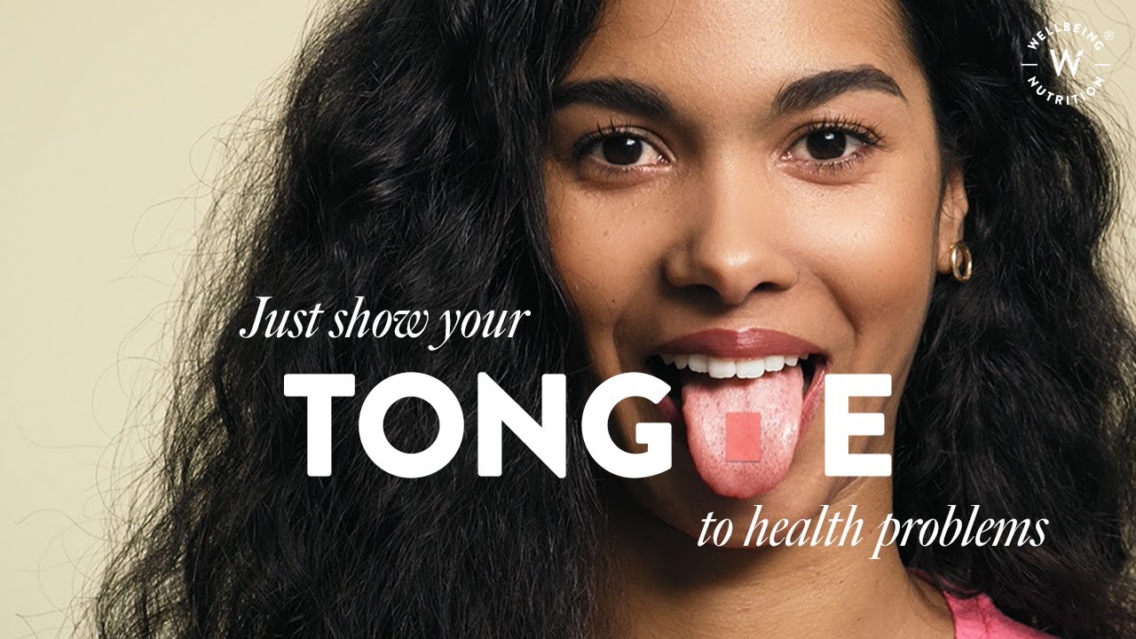 Wellbeing Nutrition | Show Your Tongue to Health Problems