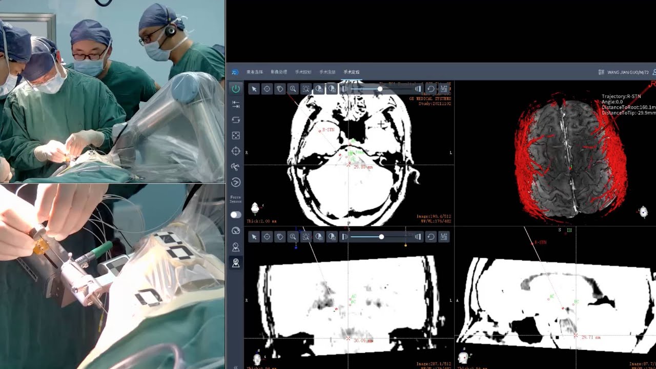 Surgical robots ready to support 2022 Beijing Winter Olympics