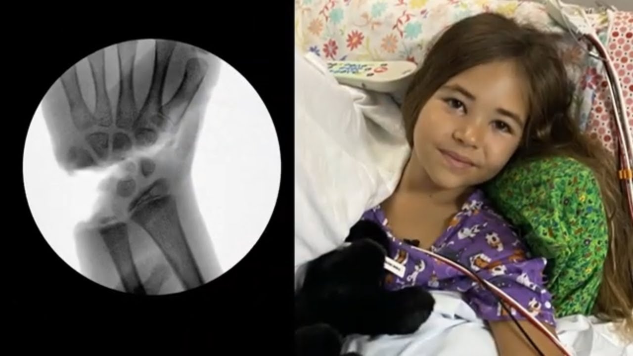 9-year-old girl has hand reattached after shark attack