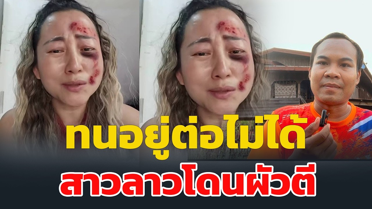 สาวลาวโดนผัวตี ทนอยู่ต่อไม่ได้