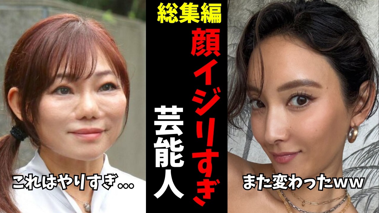 【ガルちゃん芸能】これはおかしい...顔が変わり果ててしまった芸能人　総集編【有益2ch】
