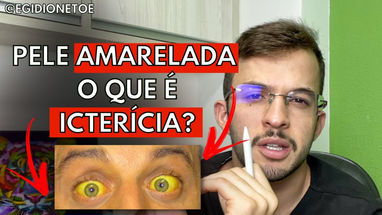 PELE AMARELADA? O QUE É ICTERÍCIA? - EGÍDIO NETO