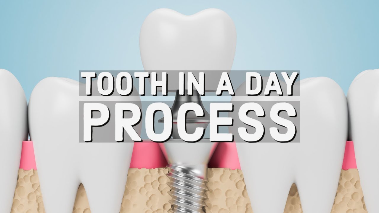 Tooth in a Day