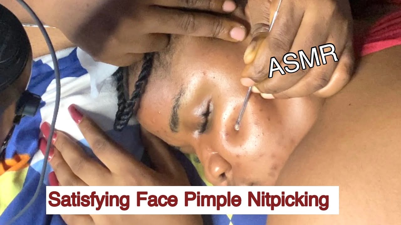 ASMR✨SATISFYING EAR AND FACE NITPICKING FOR GOOD SLEEP (NO GUM SOUNDS)