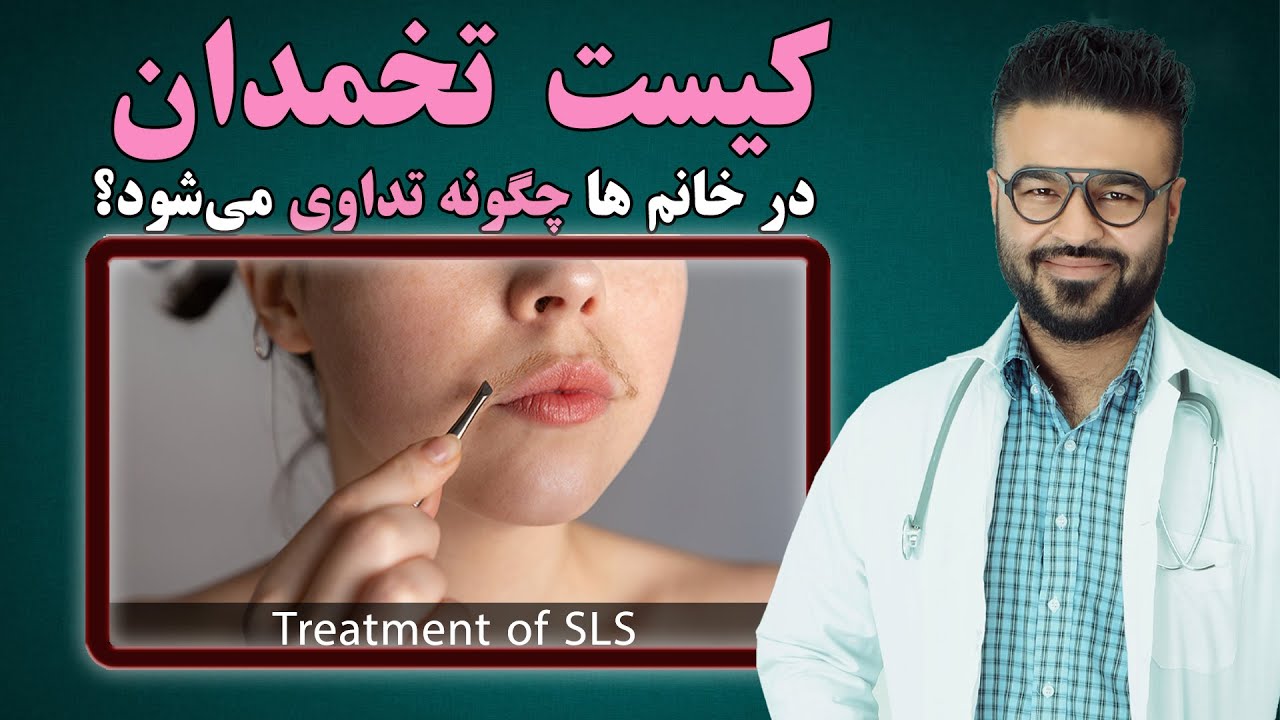 کیست تخمدان در‌خانم ها چگونه تداوی میشود؟| داکتر قیس نیکزاد