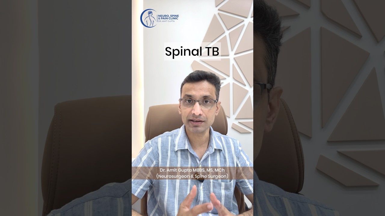 Spine की TB || Spinal tuberculosis @Dr. Amit Gupta