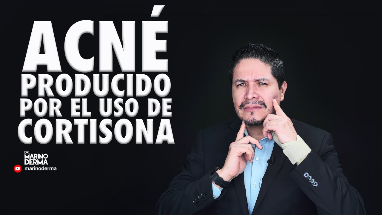 ACNE POR USO DE CORTISONA || DR MARINO DERMATOLOGO