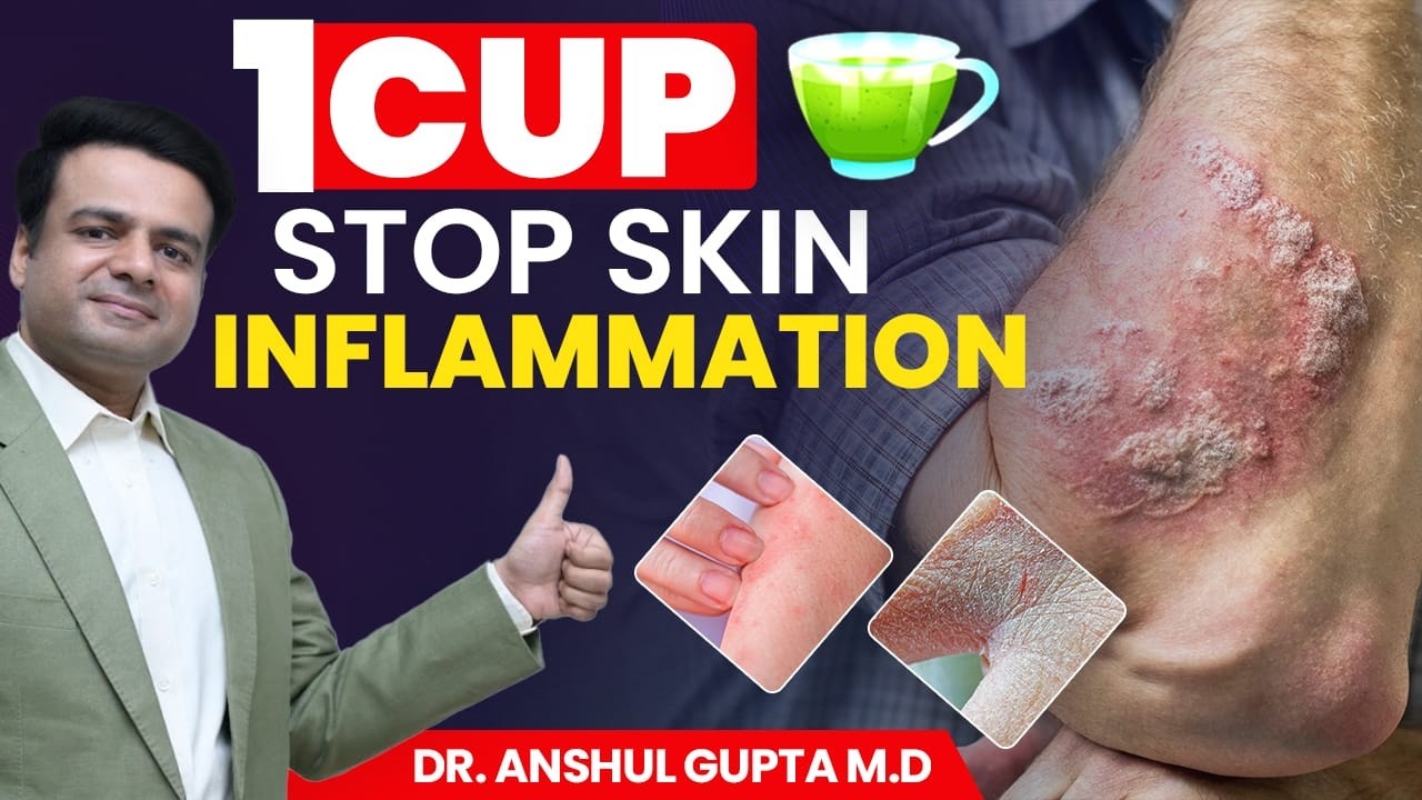 1 CUP To STOP Skin Inflammation Naturally (Boost Collagen)