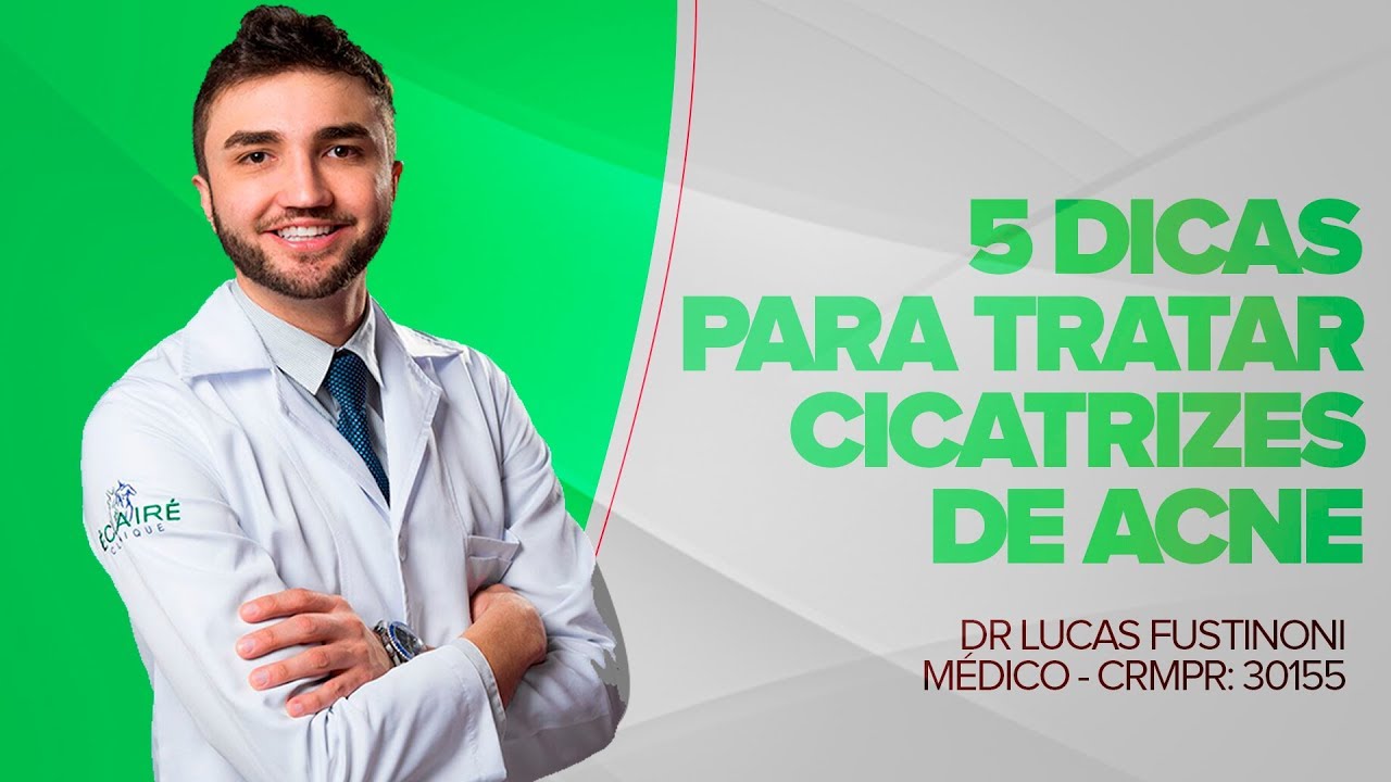 5 Dicas para tratar Cicatrizes de Acne |  Dr Lucas Fustinoni - Médico - CRMPR: 30155