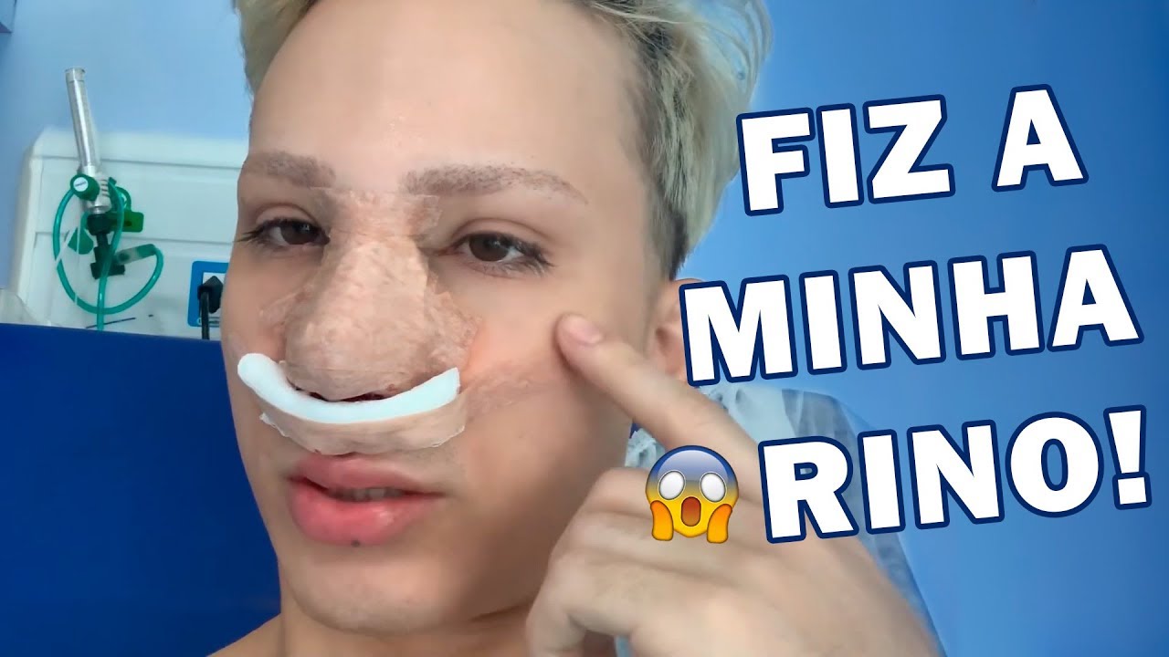 RINOPLASTIA, MINHA PRIMEIRA PL&Aacute;STICA