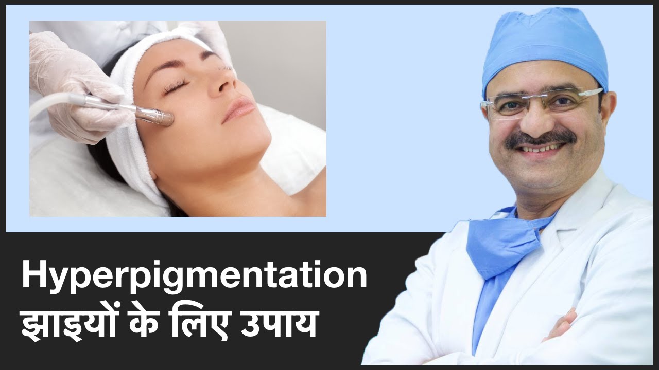 Treatments For Hyperpigmentation (झाइयों के लिए उपाय): Part 3 | ClearSkin, Pune | (In HINDI)