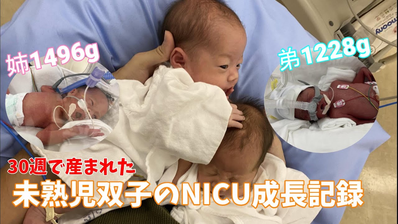 【極低出生体重児/未熟児】30週で産まれた未熟児双子のNICU成長記録