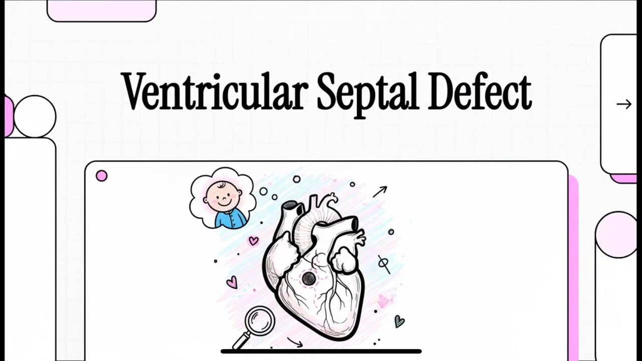 Ventricular Septal Defect (VSD)  Explained | Congenital Heart Disease Made Simple