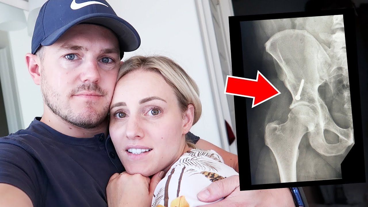 Jared's Hip Surgery Update | Not What We Wanted To Hear 😔