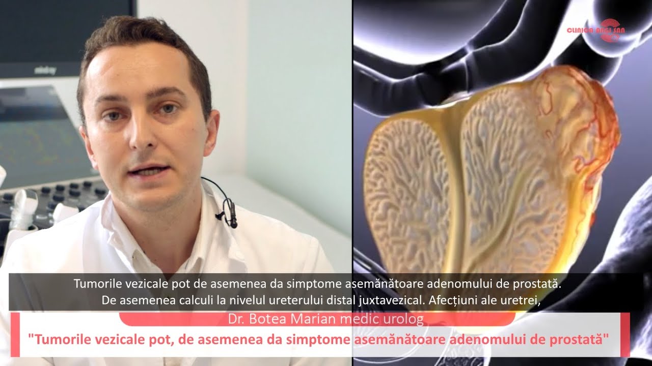 Afecțiunile prostatei - Dr. Marian Botea - Clinica Angi San