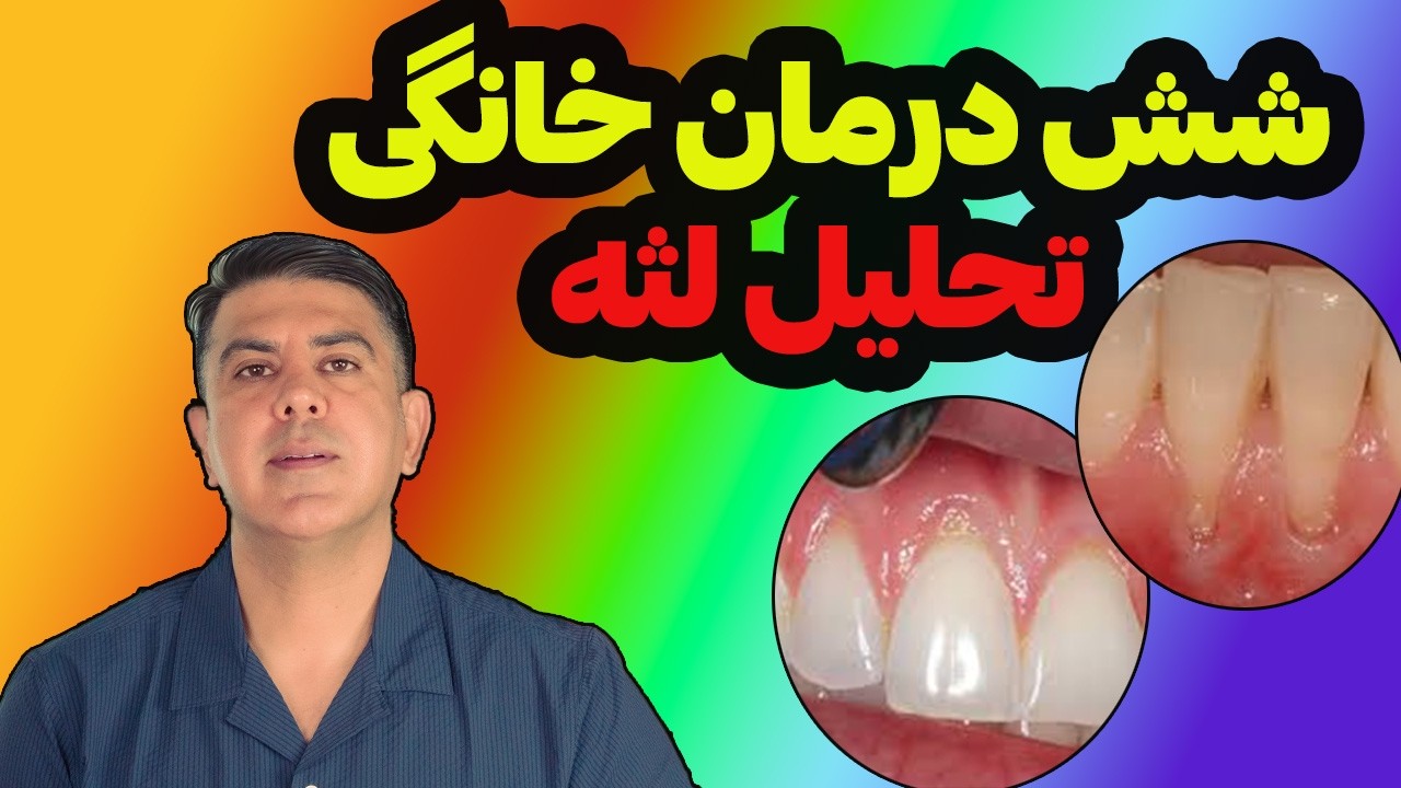 با تحلیل لثه خداحافظی کن:(شش راهکار ساده برای پیشگیری از تحلیل لثه ها)