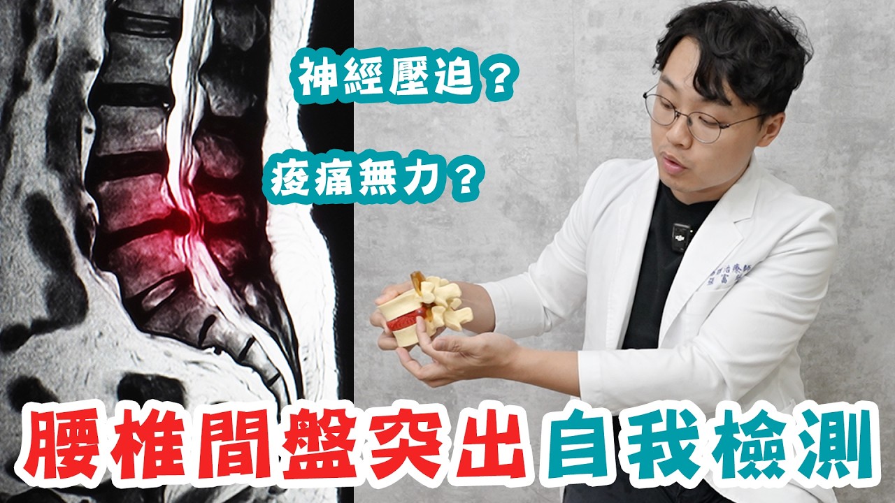 椎間盤突出如何自我檢測？痠麻無力？中央化現象 (Centralization)是治療重點！！【腰椎間盤突出系列(一)】