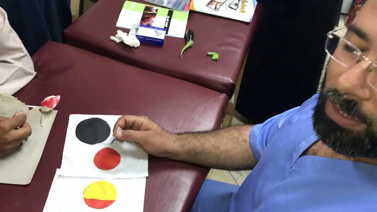 اشكال التشريط في الحجامة
