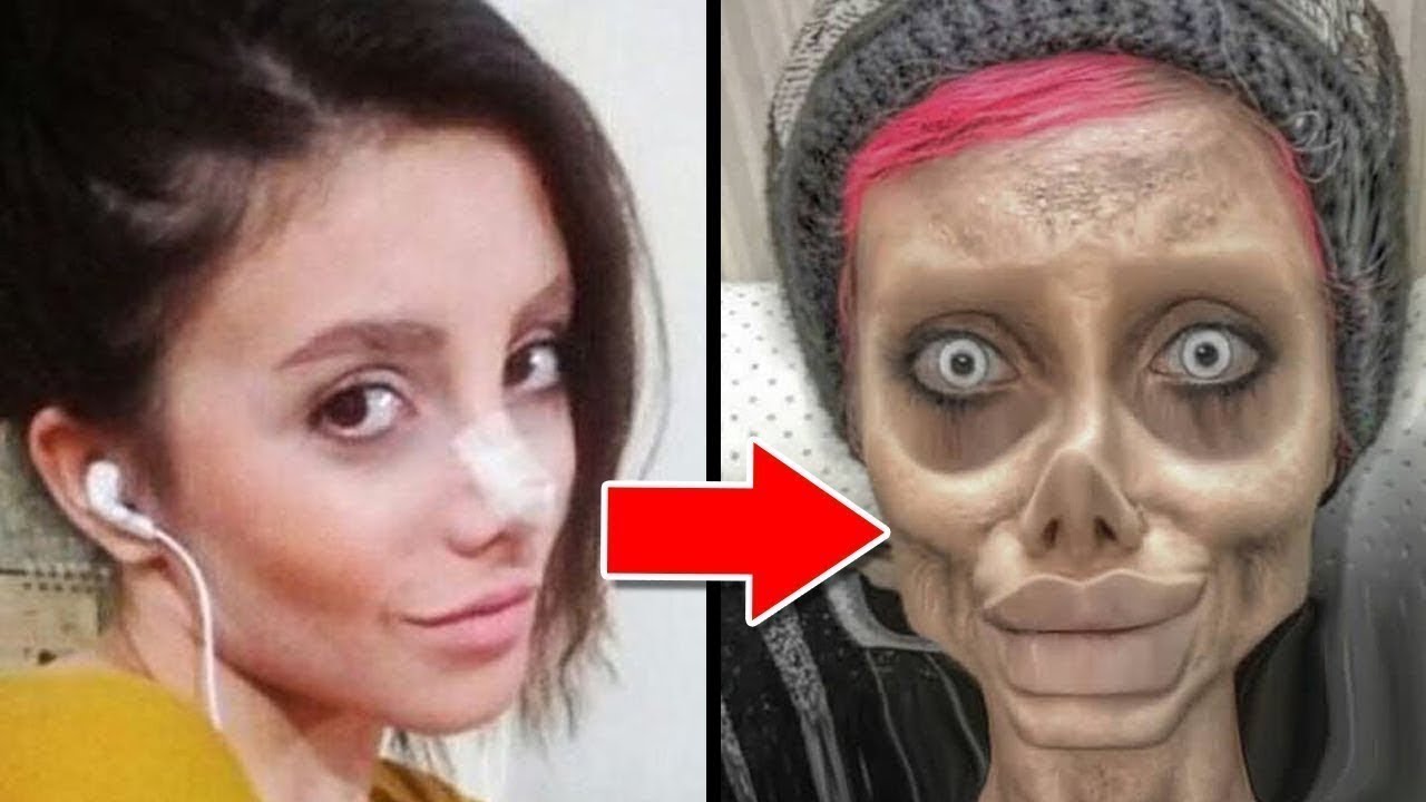 Pessoas Ricas Que Se Transformaram Em Plástico