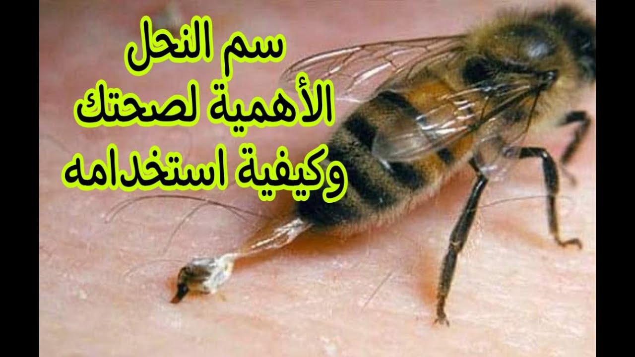 سم النحل لعلاج الأمراض.. الكيفية والاستخدام