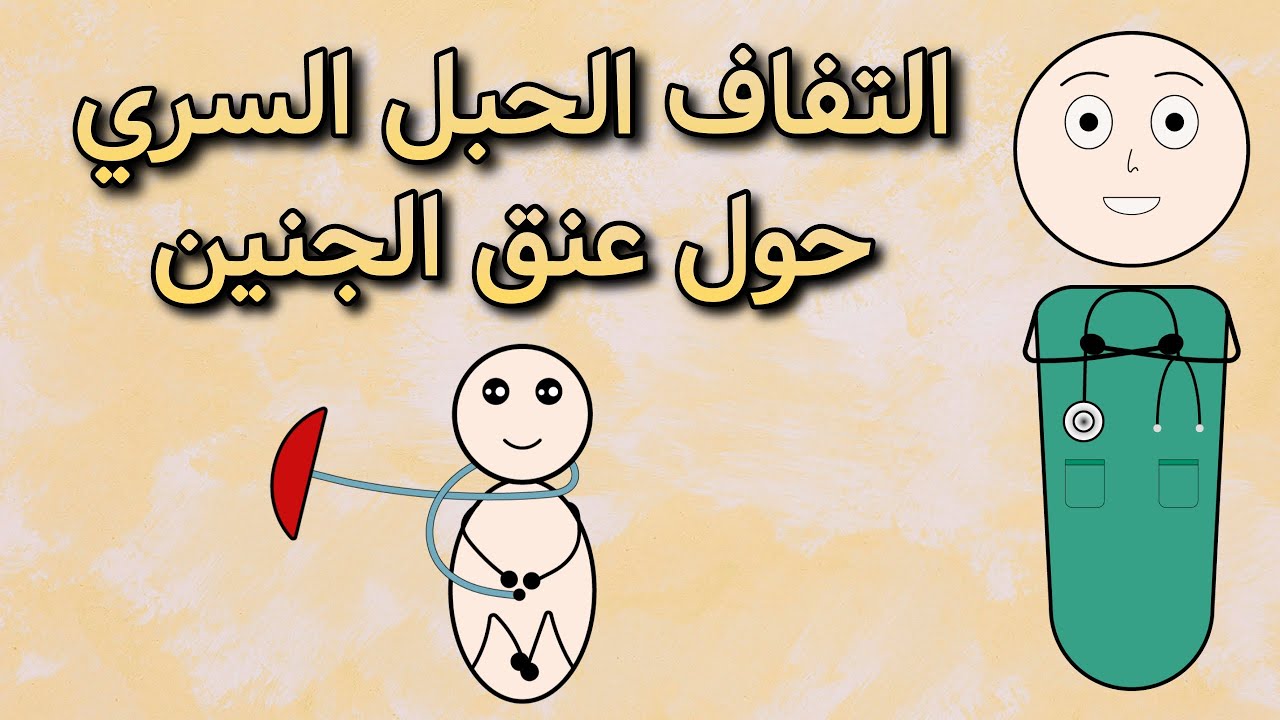 التفاف الحبل السري حول عنق الجنين