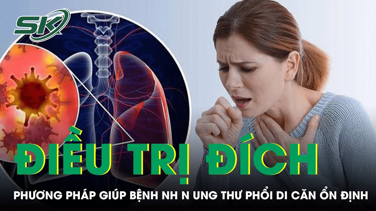 Bệnh Nh&acirc;n Ung Thư Phổi Di Căn Xương Đ&atilde; Được Điều Trị Ổn Định Bằng Phương Ph&aacute;p Điều Trị Đ&iacute;ch I SKĐS
