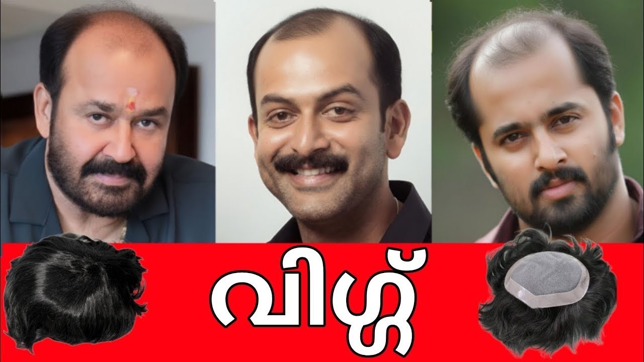 😵ദൈവമേ ഇവരൊക്കെ വിഗ്ഗായിരുന്നോ?😱 ബോധം കെട്ട് ആരാധകർ😵TOP 20 MALAYALAM ACTORS USING WIG👩‍🦲👩‍🦲