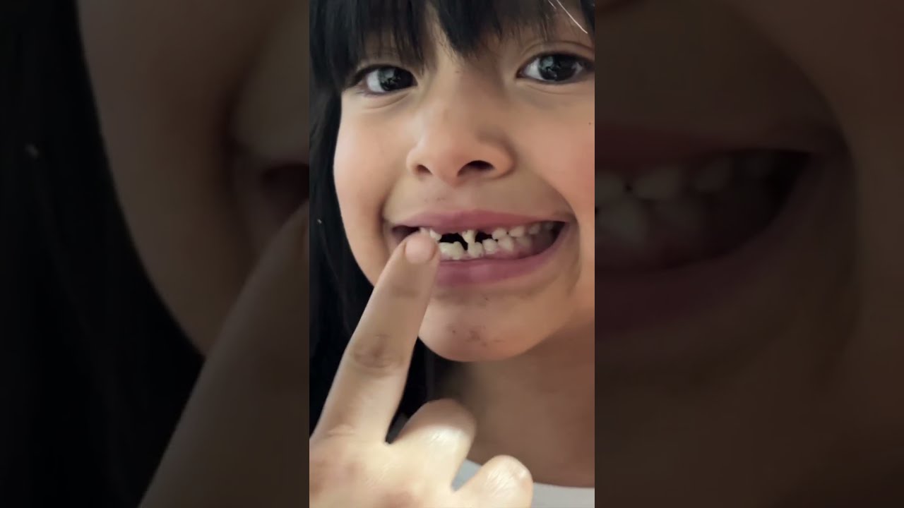 SE LE CAE DIENTE A CAELI , DRAMA TOTAL / LOS DESTRAMPADOS