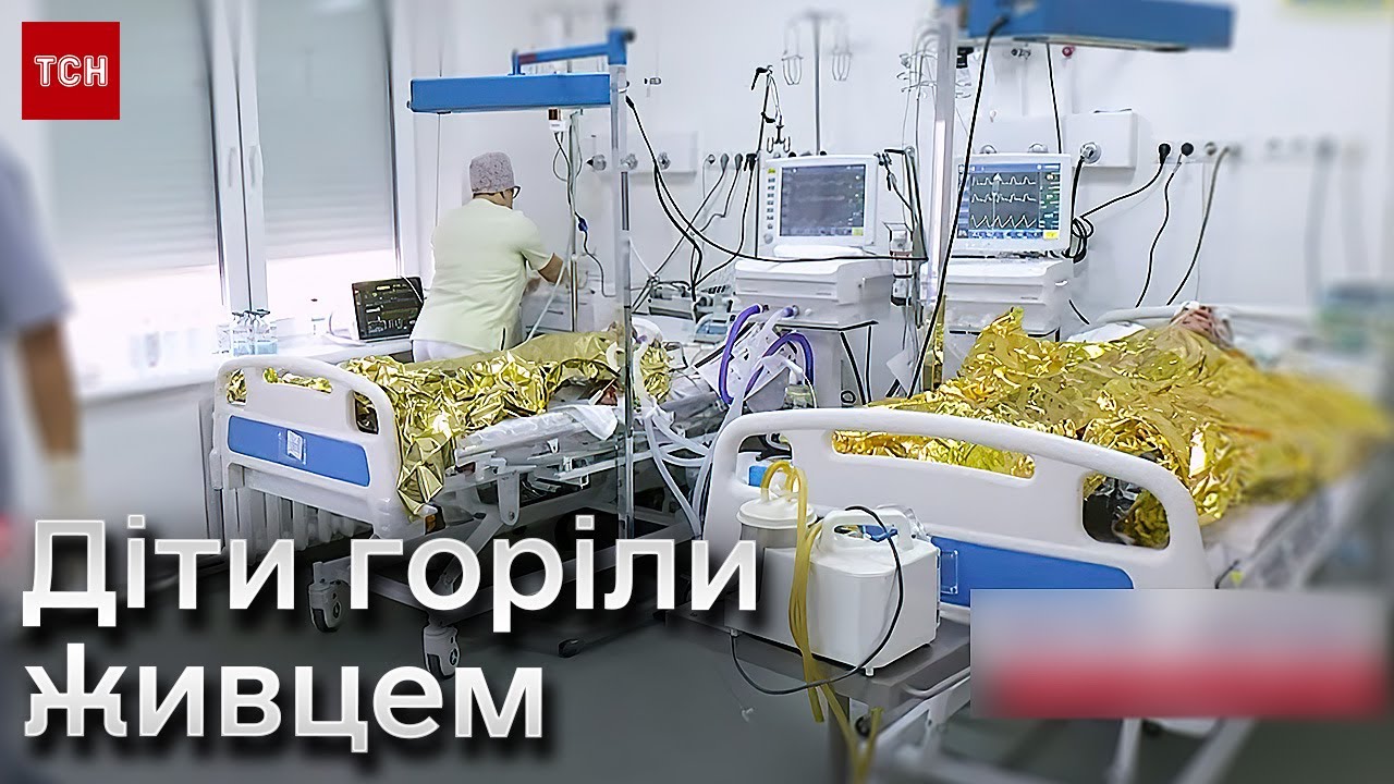 😱🔥 Діти бігли і горіли! Моторошні подробиці пожежі на нафтопроводі на Прикарпатті