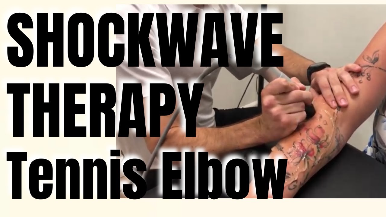 SHOCKWAVE Treatment for Tennis Elbow, San Diego