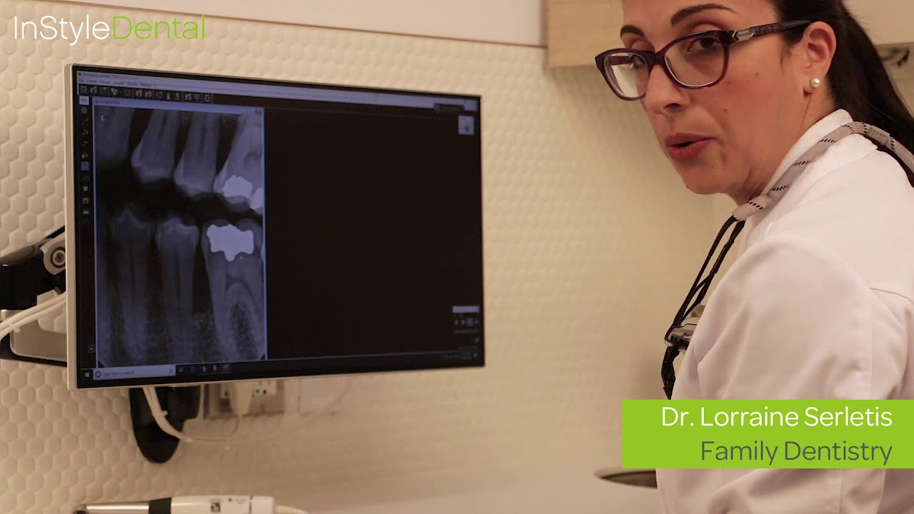 InStyle Dental Technology - CS 1500 Intraoral Camera