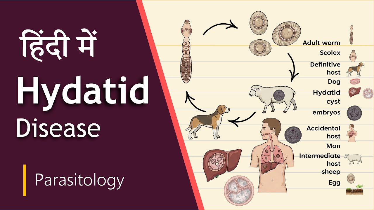 Life Cycle of Echinococcus granulosus | Hydatid Disease | हिंदी | Biology Goal Hindi