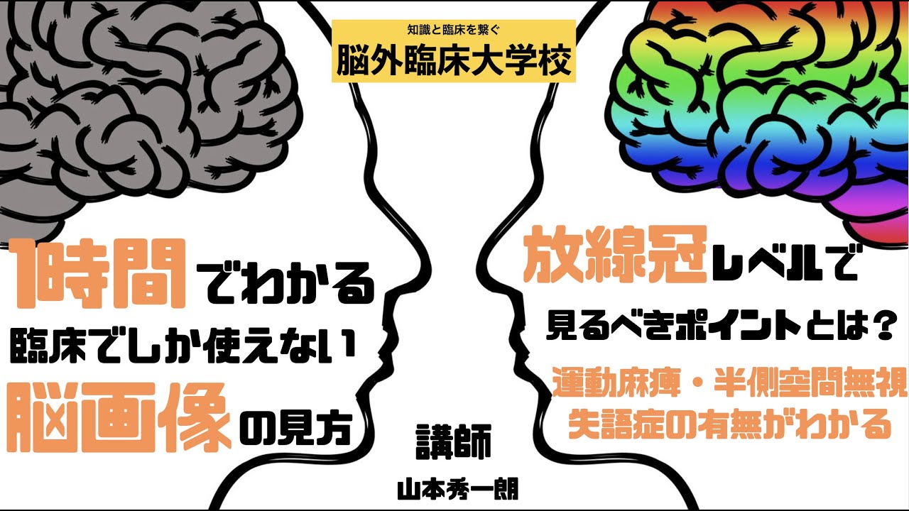 １時間でわかる臨床でしか使えない脳画像の見方　放線冠レベルで見るべきポイント①