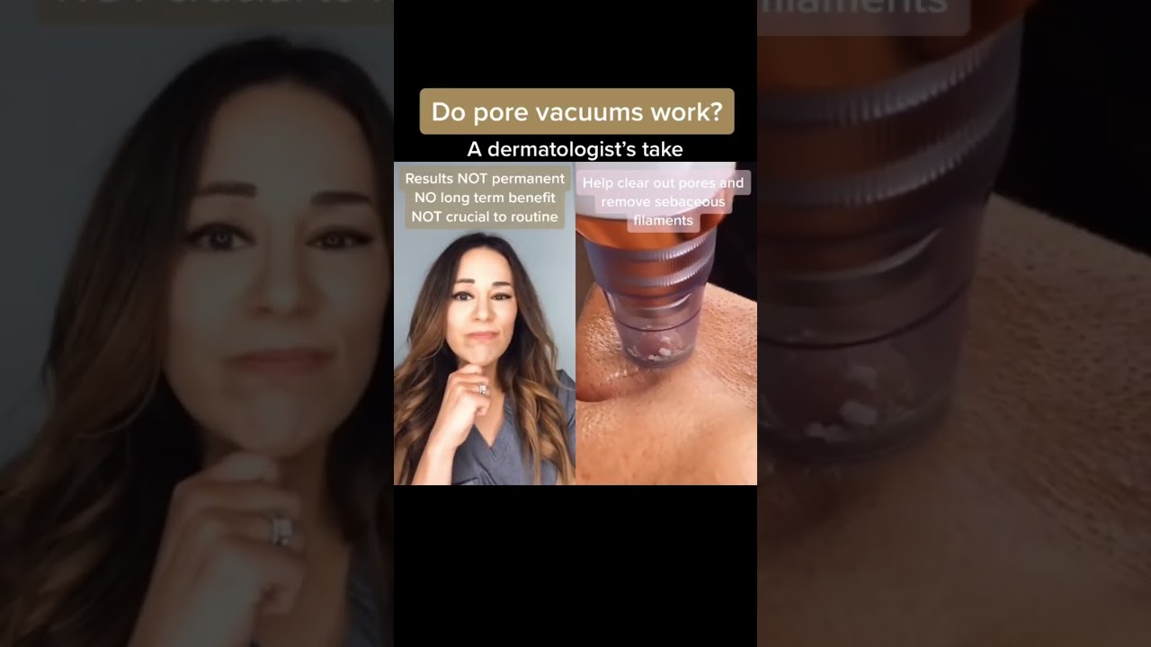 Do Pore Vacuums REALLY Work? &ndash; Dermatologist Reacts | #shorts #skincare |